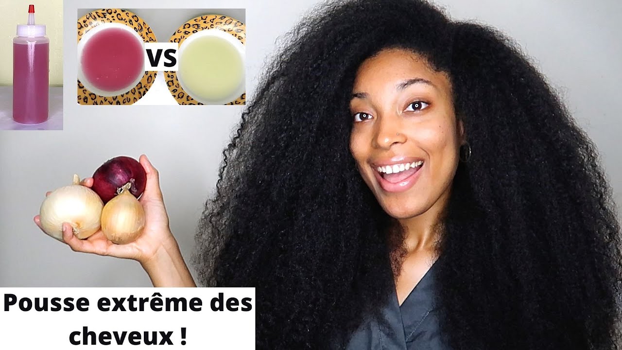 Les bienfaits de l’oignon sur les cheveux - astuces pour tous