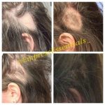 Hair Loss Treatment Hair growth Cream 1 Month Supply Balding Alopecia Thin Edges Bald Spots For Men or Women Black Castor Oil
