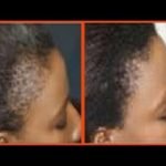 STOPPER LA CHUTE et FAIRE POUSSER LES CHEVEUX 2X PLUS VITE en 2 SEMAINES