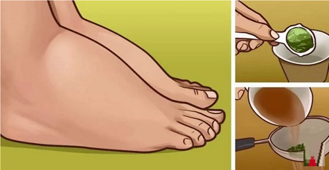 comment soigner vos chevilles et pieds enflés